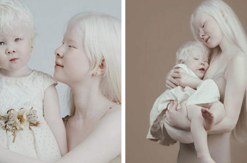  Albino sisters from Kazakhstan are a real miracle!