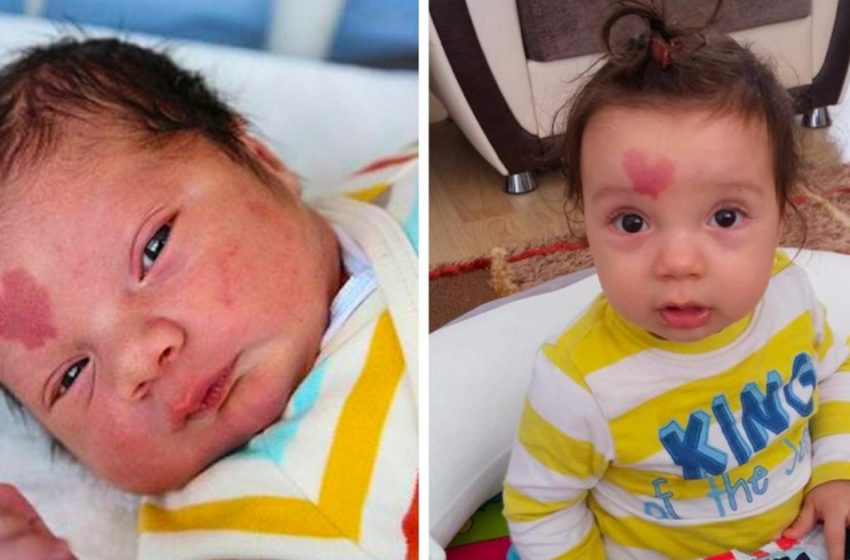  A baby who was born with a birthmark on his forehead in the form of a heart is now already 6 years old. Look at his photos