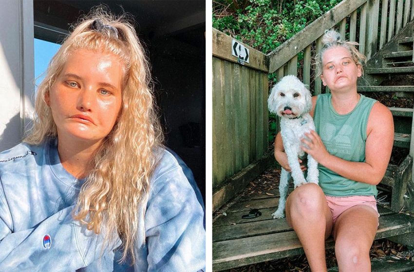  How the ‘Girl who can’t smile’ learned to accept her beauty and became a successful model