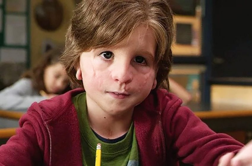  “You can’t recognize without makeup”: what does the actor who played the boy Oggy in the film “Miracle” look like today