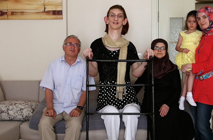  What the tallest woman in the world looks like and how she lives