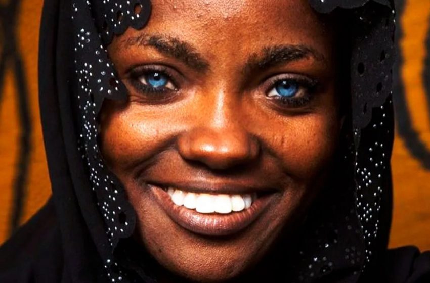  A dark-skinned woman with blue eyes became a mother 2 babies who have really unique appearance