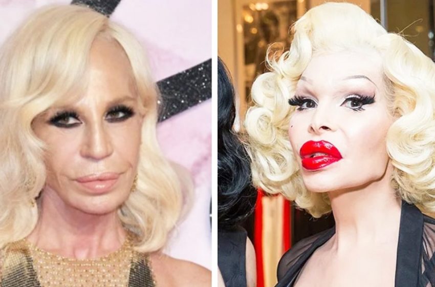  “Why did they do it?”: some famous women who spoiled their appearance with plastic surgery