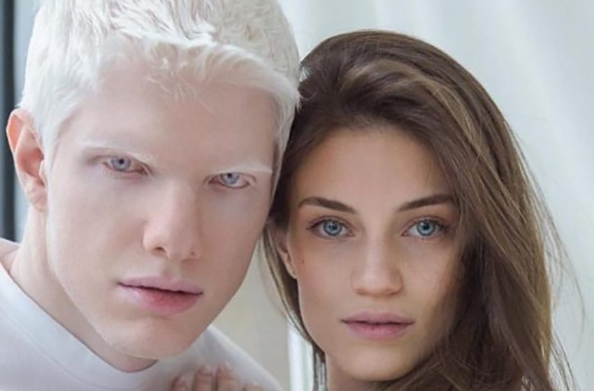  “Like a little angel”: what the son of the model and the most beautiful albino in the world looks like