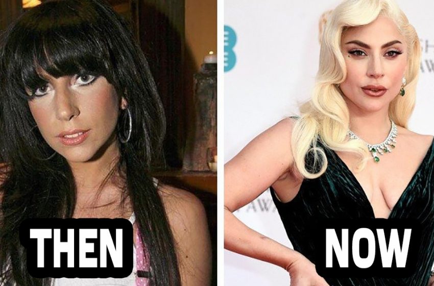  They were obsessed with plastic surgery: some famous stars who did everything to change themselves