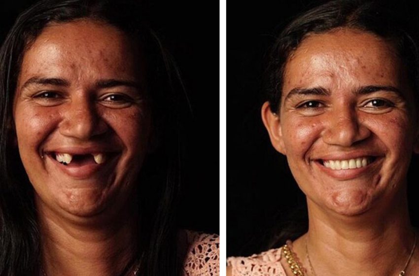  He did a real magic: Brazilian dentist transformed 12 people by giving them a beautiful smile for free