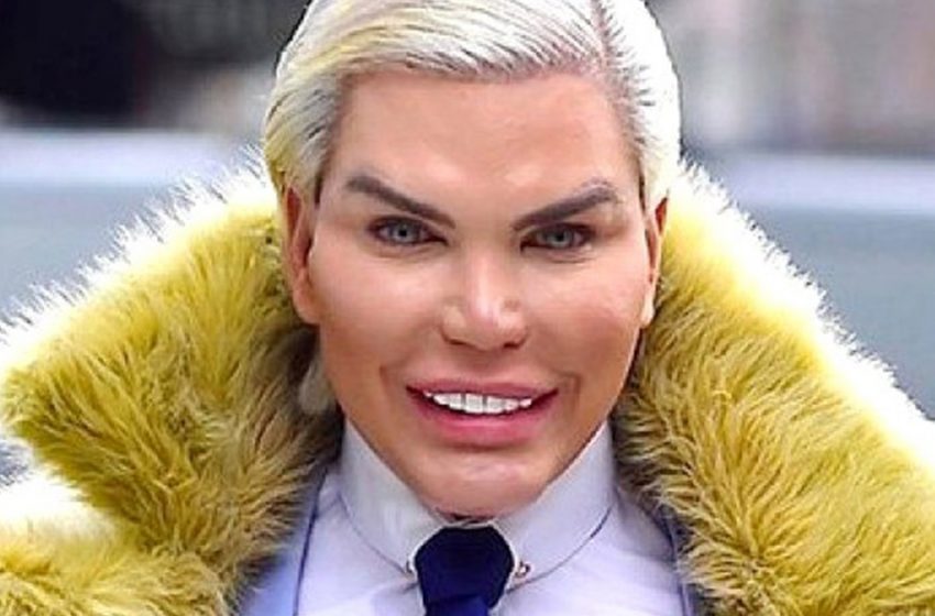  He was really a nice guy: What Rodrigo Alves looked like before plastic surgery