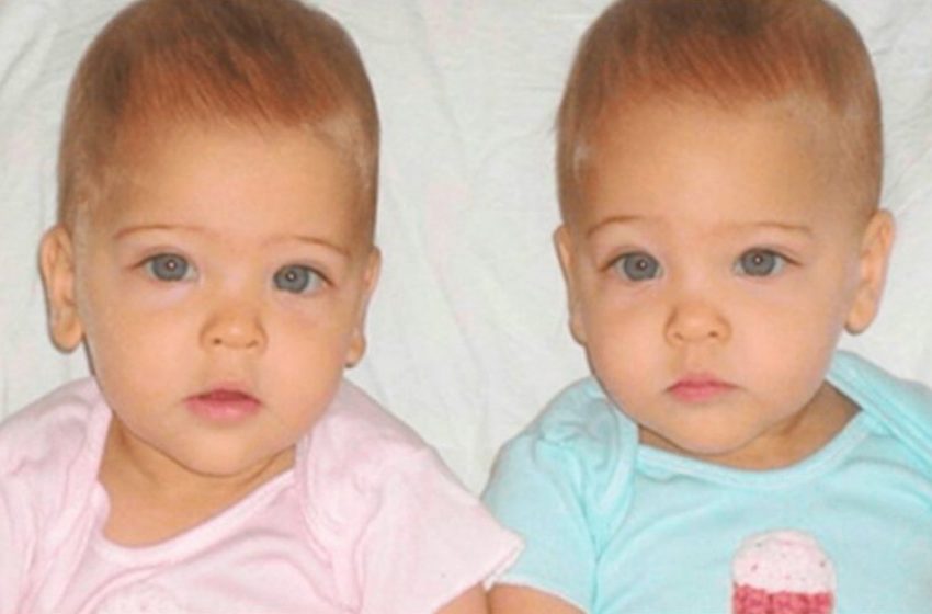  They have still kept their charm: What the most beautiful twins of the world look like at their mature age