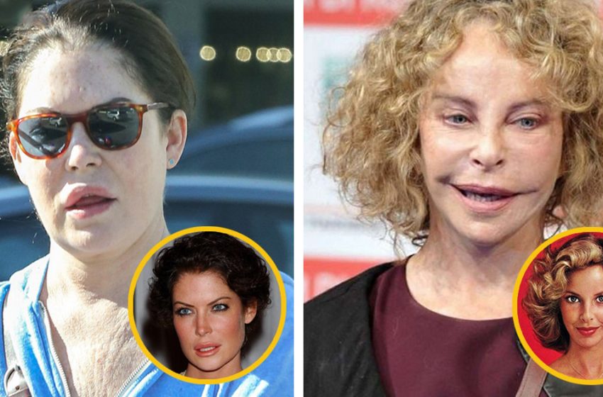  They just spoiled themselves: Photos of stars whose career faded away after plastic surgery