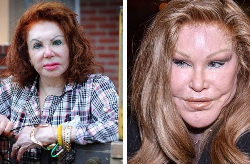  Their transformations are failed: Examples from celebrities who show that jokes are bad with plastic surgery
