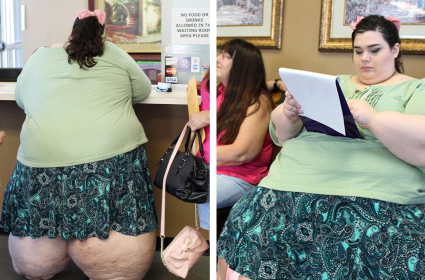  The transformation is unbelievable: What the girl, who has lost 440 pounds, looks like now