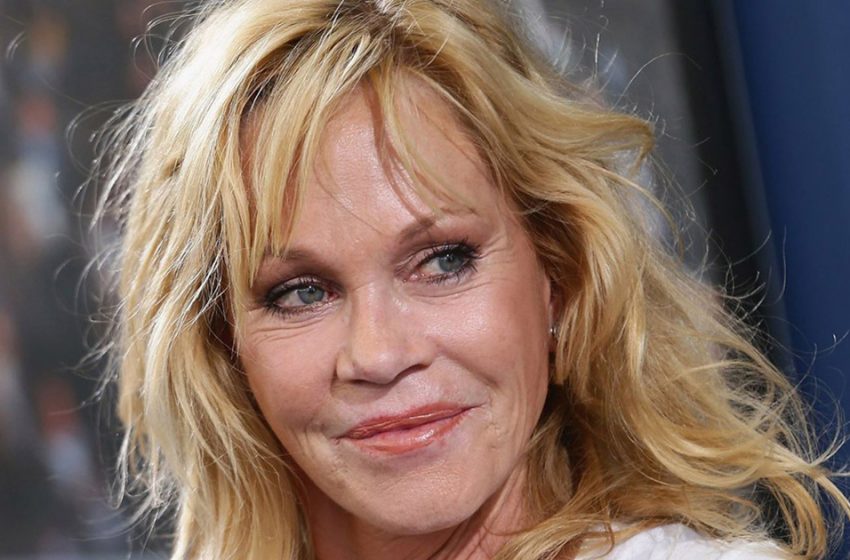  Fresh scars and ulcers on the face: how 65-year-old adorable actress Melanie Griffith looks today