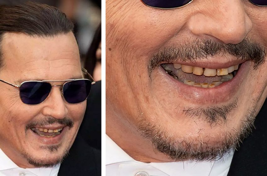 They don’t care about the Hollywood smile: Photos of famous stars who have kept their natural teeth