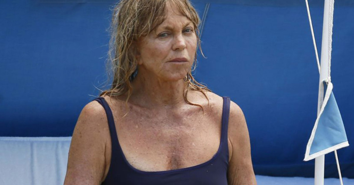 Age Takes Its Toll 78 Year Old Goldie Hawn In A Bodysuit Was Captured On Vacation Beaware 1477