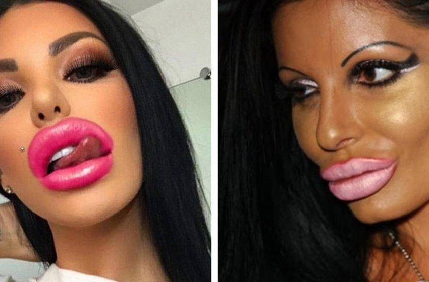  “What’s the world coming to?”: these girls have clearly overdone the plastic