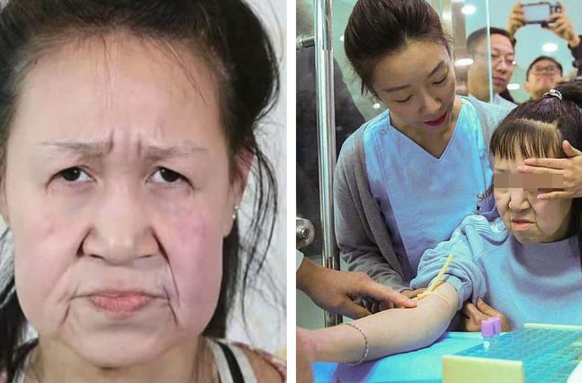  How was the life of Xiao Feng, a Chinese woman who looked like an old woman when she was 15