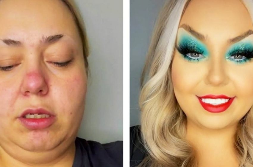  The miracle of transformation: How a blogger with no teeth was able to transform herself into a beauty in the blink of an eye