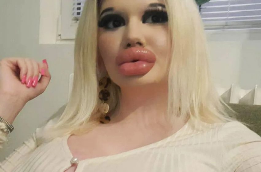  She injected 27 fillers into her lips. What the Bulgarian-born woman looked like before all the makeovers