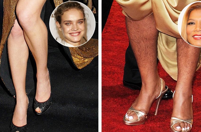  “Weird Naturalness”: Shots Of Celebrities Who Stand For Natural Beauty!