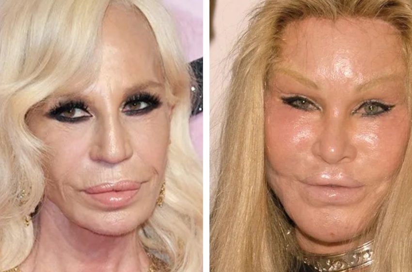  “Why did they do it?”: popular women who ruined their looks with plastic surgery