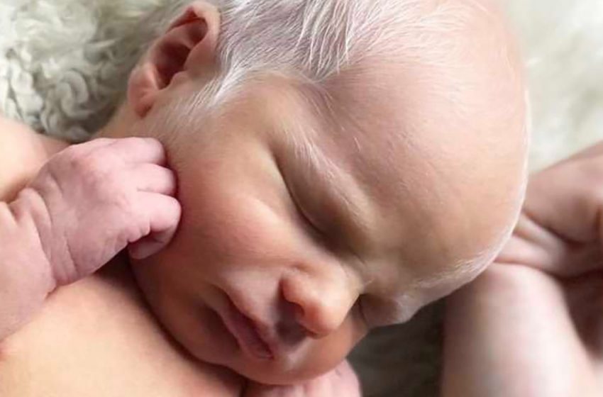  “The Baby Was Mocked For Having White Hair”: What Does He Look Like Now?