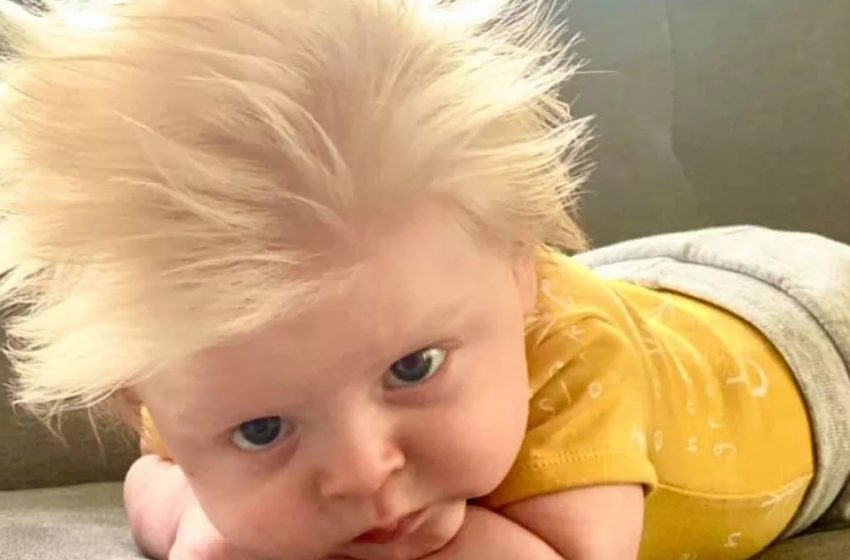  “Surprise For Mom And Dad”: A Baby Born With Incredibly Long Hair Captivates The Net With His Cute Photos!