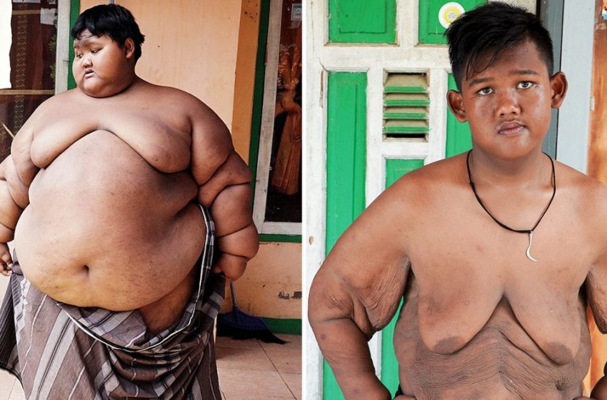  “Nothing Is Impossible”: The Fattest Boy With A Weight Of 421 lbs Has Lost Lots Of Weight And Changed Beyond Recognition!