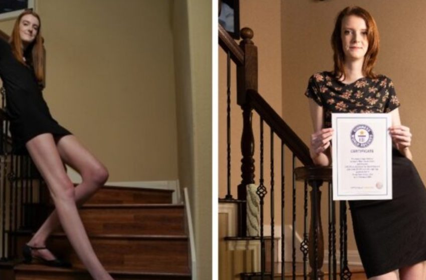  “Every Model’s Dream”: What Does The Girl With The Longest Legs In The World Look Like?