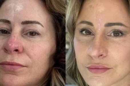 A 50-Year-Old Woman Sold Her House For a “New Face”: What Does The Homeless Woman Look Like Now – After a Facelift?