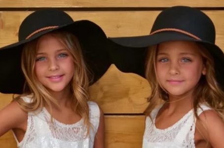“They Were Considered To Be The Most Beautiful Twins In The World”: How Have They Changed Over The Last 7 Years? Are They Still As Beautiful As They Used To Be?