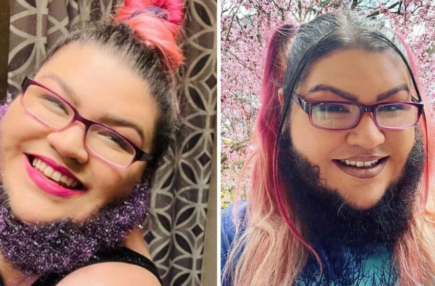  “She Shocks All Passersby”: Why Did a 29-Year-Old Girl Decide To Grow a Natural Beard?