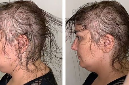 “What an Amazing Transformation”: The Hairdresser Managed To Create a Chic Hairstyle From Rare Hair!