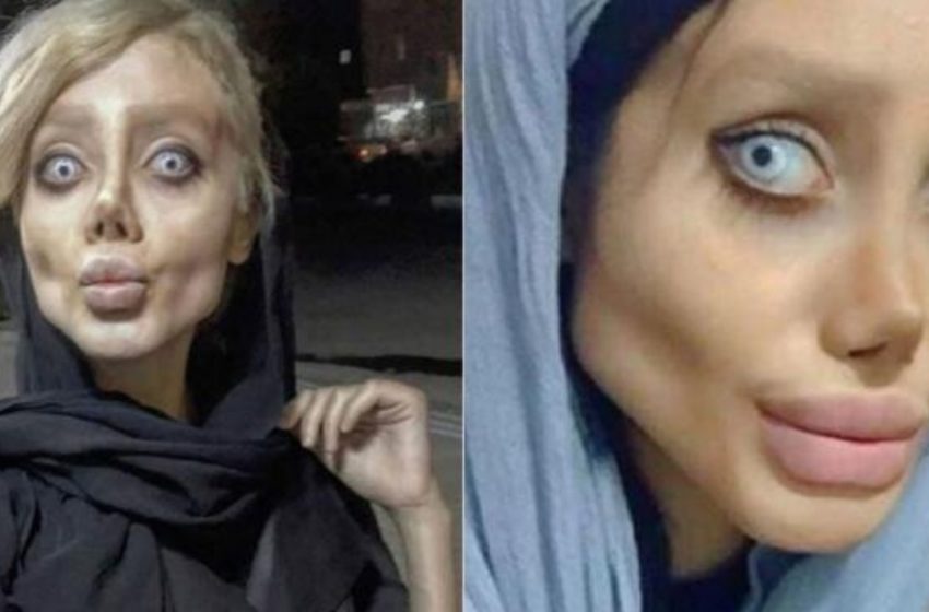  “It Is Even Scary To Look At Her”: She Underwent 50 Surgeries And Lost 90 lbs To Look Like Angelina Jolie!