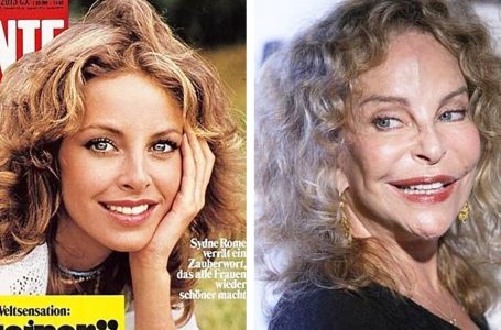 “When Things Go Wrong”: 7 Celerbrities Who Have Changed Beyond Recognition Due To Plastic Surgery!