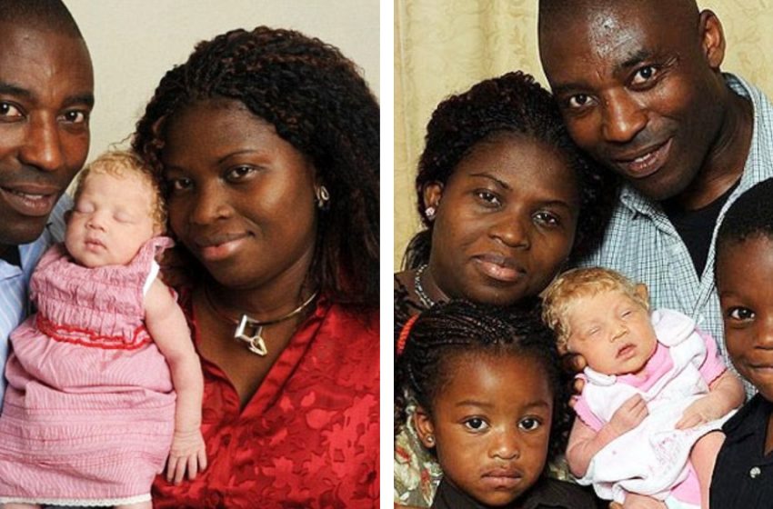  “The Birth Of a “Snow White” Girl In a Nigerian Family 10 Years Ago Shocked Everyone”: What Does She Look Like Today?