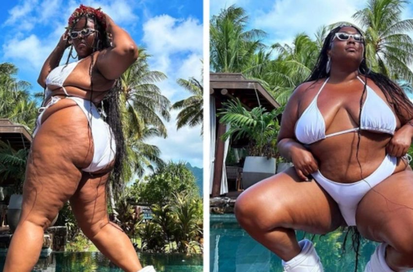  Celebrities Who Share Real, Unedited Photos Of Themselves: Rare Shots Of Stars Who Are Not Afraid Of Showing Cellulite, Pimples, And Stretch Marks!