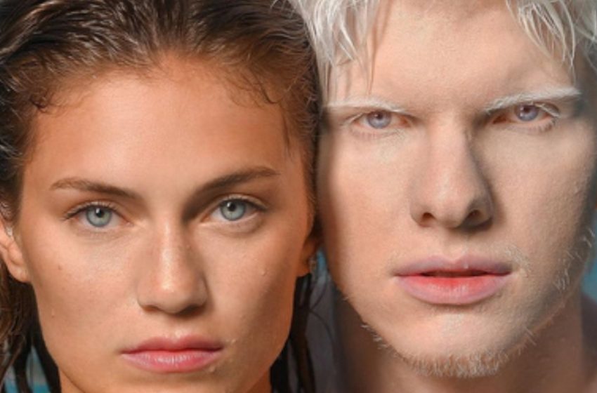  What Does The Son Of The Most Beautiful Albino And Georgian Model Look Like?: “A Boy With Special Beauty!”