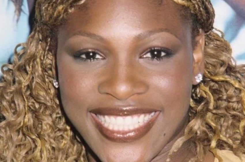  “Too Much Filler?”: Serena Williams Faces Criticism for Her Dramatically Changed Appearance!