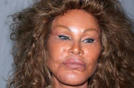 “Catwoman”: Jocelyn Wildenstein Shares Rare Photo Showing Her Pre-Transformation Look!