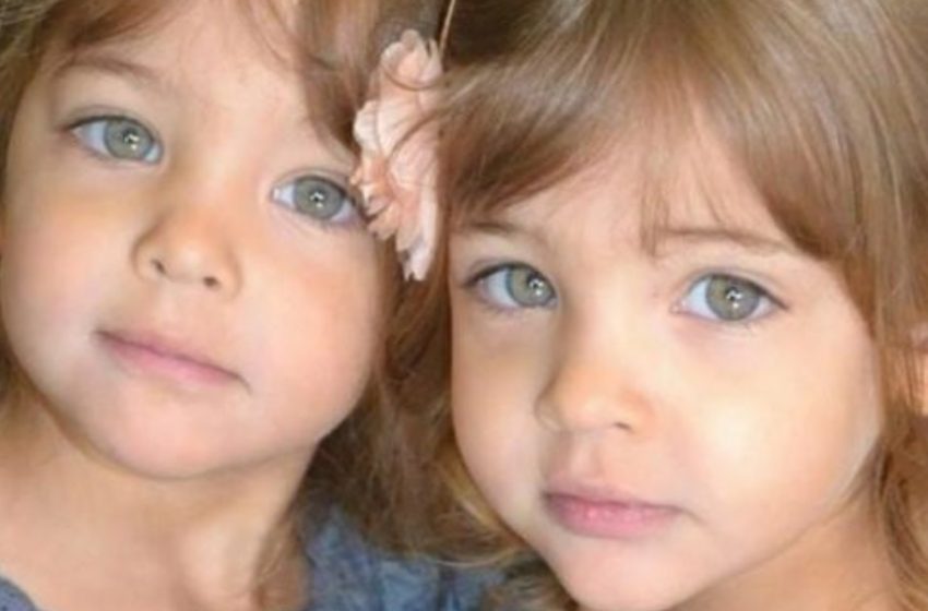  “They Were Called The Most Beautiful Twins in The World!”: What Do They Look Like Now?