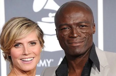 Why Singer Seal Has Scars on His Face!:  What Would He Look Like Without Them!