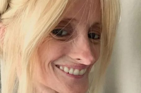 The Woman, 41, Ages Several Times Faster Due To a Rare Syndrome: Her Pics!