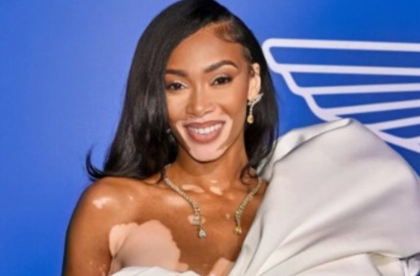  Winnie Harlow Gets Engaged with a Stunning Ring on a Private Jet: What Does Her Partner Look Like?