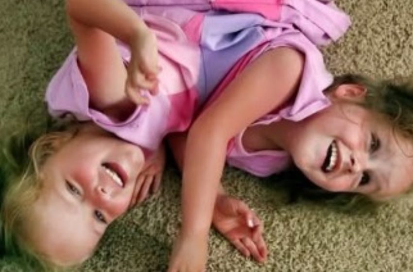  “Separated At 4, Now 18 Years Later!”: How Do These Twins Look Now After a 26-Hour Separation Surgery?