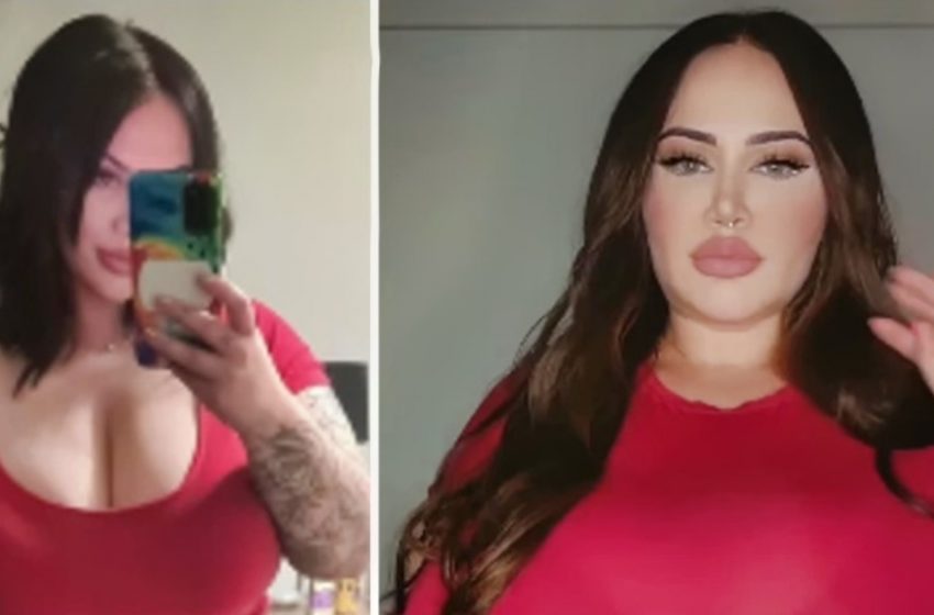  A Woman with Rare Condition Spends Terrifying Sums on Bras as Her Breasts Keep Growing!