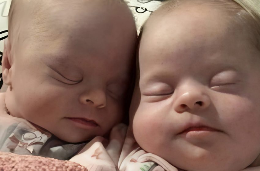  Mom of Twins with Down Syndrome Silences Critics with Powerful Response: What Did She Say?