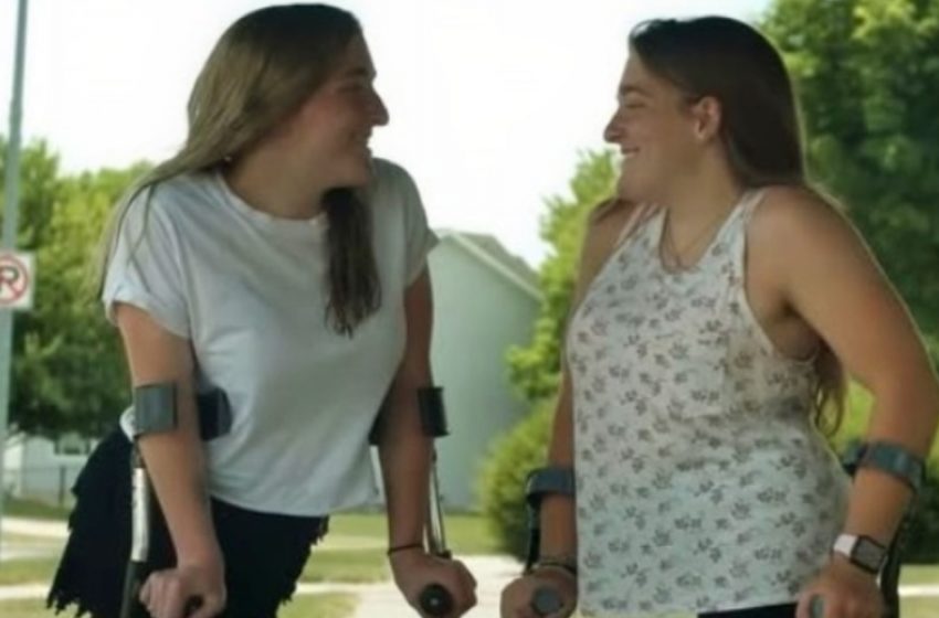 Formerly Conjoined Twins Are Now Thriving Teens Living a Normal Life!: 10 Years After Their Life-Changing Surgery!
