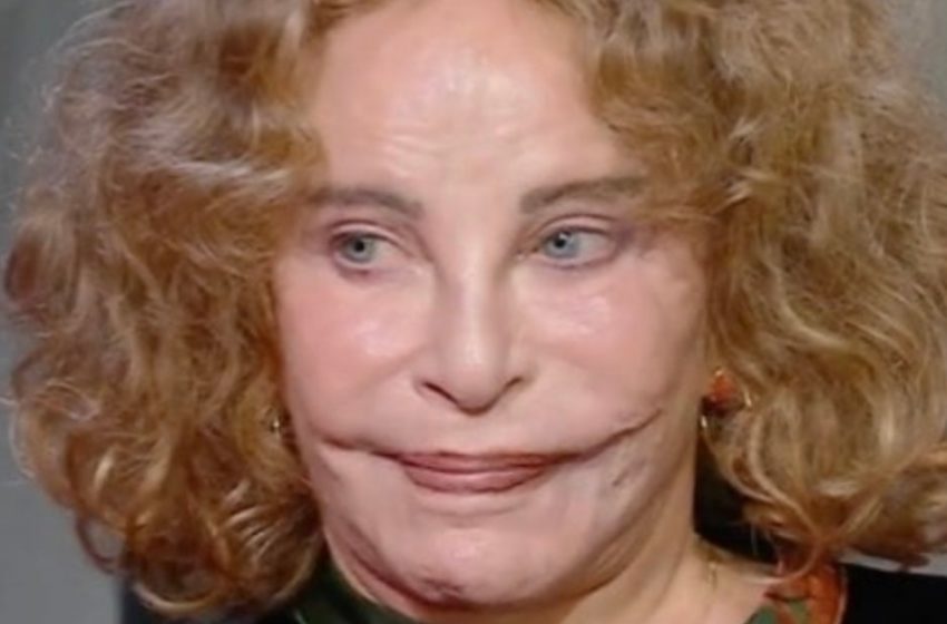 She Was Once Called The Most Beautiful Woman In The World: But a Tragic Accident Disfigured Her Face!