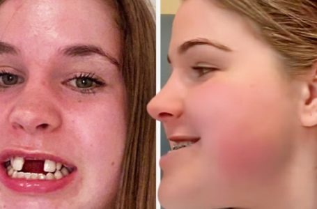 They Laughed at Her Looks!: But 6 Years Later, She Took Everyone’s Breath Away!