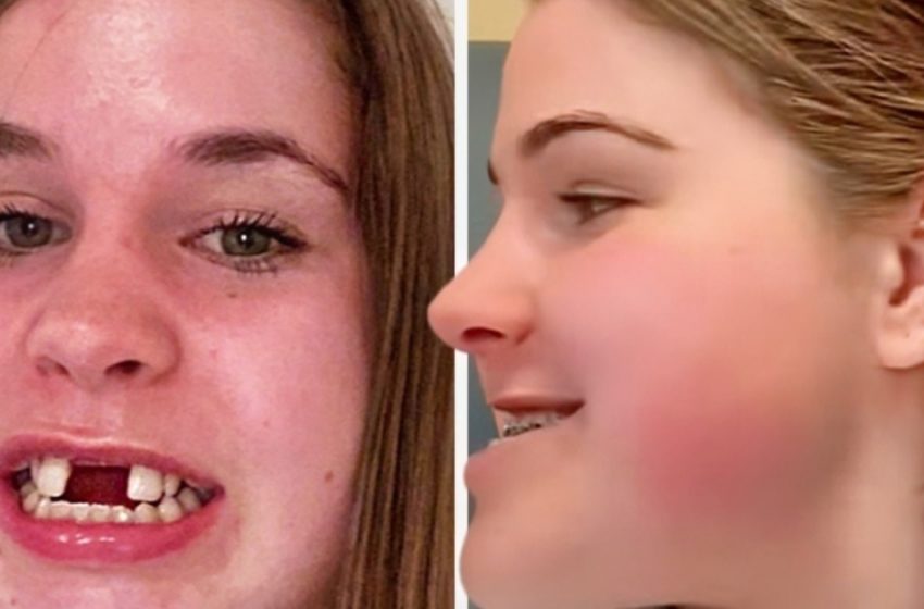 They Laughed at Her Looks!: But 6 Years Later, She Took Everyone’s Breath Away!